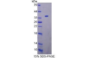 SDS-PAGE analysis of Mouse KEL Protein. (KEL Protéine)