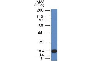 Image no. 1 for anti-Mast/stem Cell Growth Factor Receptor (KIT) (AA 100-300) antibody (ABIN6190751) (KIT anticorps  (AA 100-300))