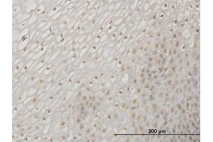 Immunoperoxidase of monoclonal antibody to ERN1 on formalin-fixed paraffin-embedded human esophagus. (ERN1 anticorps  (AA 401-500))