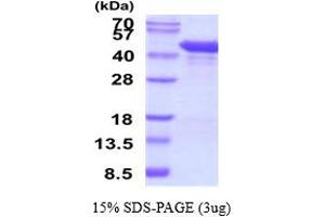 SDS-PAGE (SDS) image for Matrix Metallopeptidase 1 (Interstitial Collagenase) (MMP1) (AA 100-469) protein (His tag) (ABIN5853523) (MMP1 Protein (AA 100-469) (His tag))