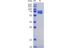 Human SLAMF5 Protein, mFc-His Tag on SDS-PAGE under reducing condition. (CD84 Protein (CD84) (mFc-His Tag))