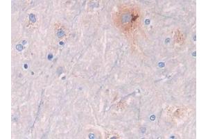 DAB staining on IHC-P; Samples: Rat Spinal cord Tissue