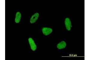 Immunofluorescence of purified MaxPab antibody to RNF168 on HeLa cell.