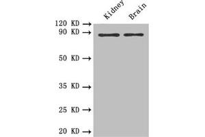 Western blot All lanes: PTPRE antibody at 0. (PTPRE anticorps)