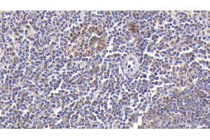 Detection of CXCL2 in Human Spleen Tissue using Polyclonal Antibody to Chemokine (C-X-C Motif) Ligand 2 (CXCL2) (CXCL2 anticorps  (AA 34-107))