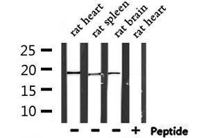 Western blot analysis of extracts from rat heart ,rat spleen and rat brain, using PTP4A3 Antibody.