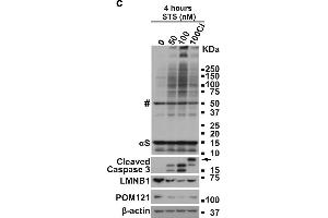 Apoptosis induces αS aggregation and phosphorylation in BE(2)-M17D/3D5 cells.