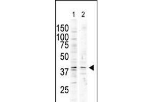 The anti-P38delta C-term Pab (ABIN6242133 and ABIN6578997) is used in Western blot to detect P38 delta in nocodazole-treated HC (lane 1) and A-treated Pam212 (lane 2) cell lysates. (MAPK13 anticorps  (C-Term))