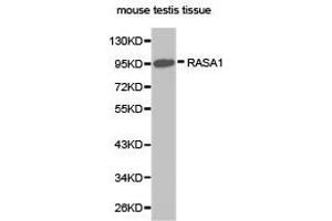 Western Blotting (WB) image for anti-RAS P21 Protein Activator (GTPase Activating Protein) 1 (RASA1) antibody (ABIN1874554) (RASA1 anticorps)