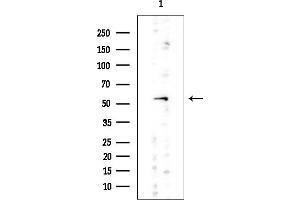 Western blot analysis of lysates from Rat testis, using ALDH7A1 Mouse Monoclonal Antibody at 1/1000 dilution.