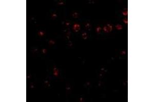 Immunofluorescence of Integrin alpha 4 in Jurkat cells with AP30435PU-N Integrin alpha 4 antibody at 2 μg/ml.