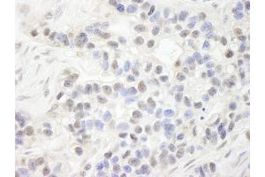 Immunohistochemistry (IHC) image for anti-Ubiquitin-Like, Containing PHD and RING Finger Domains, 1 (UHRF1) (AA 275-325) antibody (ABIN7448698)