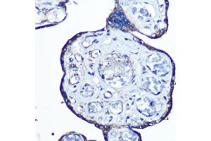 Immunohistochemistry of paraffin-embedded human placenta using N-WASP/N-WASP/WASL Rabbit mAb (ABIN7268856) at dilution of 1:100 (40x lens). (Neural Wiskott-Aldrich syndrome protein (WASL) anticorps)