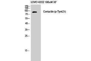 Western Blotting (WB) image for anti-Cortactin (CTTN) (pTyr421) antibody (ABIN3181971) (Cortactin anticorps  (pTyr421))