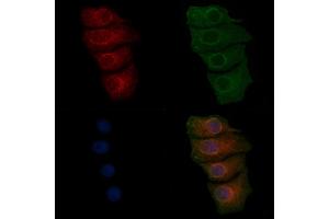ABIN7093224, ABIN7097235 and ABIN7097236 staining HepG2 cells(30 min of 4uM Forskolin treatment) by IF/ICC.