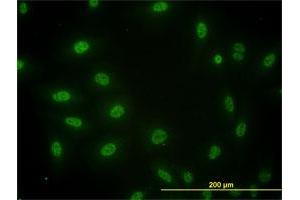 Immunofluorescence of monoclonal antibody to SMAD3 on HeLa cell.