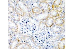 Immunohistochemistry of paraffin-embedded Rat kidney using RLN2 Polyclonal Antibody at dilution of 1:200 (40x lens). (Relaxin 2 anticorps)