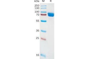 Human IL1RA Protein, hFc Tag on SDS-PAGE under reducing condition.
