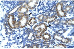 Rabbit Anti-FLJ14768 Antibody Catalog Number: ARP30009 Paraffin Embedded Tissue: Human Kidney Cellular Data: Epithelial cells of renal tubule Antibody Concentration: 4. (FIZ1 anticorps  (C-Term))