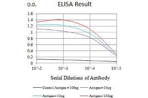 Black line: Control Antigen (100 ng),Purple line: Antigen (10 ng), Blue line: Antigen (50 ng), Red line:Antigen (100 ng)