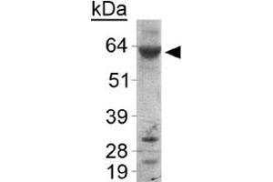 Western blot analysis of PLIN1 in human liver samples with PLIN1 polyclonal antibody . (PLIN1 anticorps  (AA 450-522))