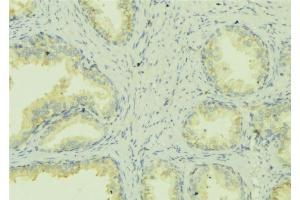 ABIN6278425 at 1/100 staining Mouse colon tissue by IHC-P.