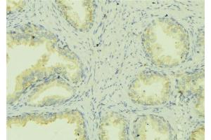 ABIN6278425 at 1/100 staining Mouse colon tissue by IHC-P. (ATP7A anticorps  (C-Term))