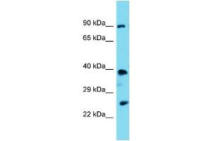 Western Blotting (WB) image for anti-Proline-serine-threonine Phosphatase Interacting Protein 2 (PSTPIP2) (N-Term) antibody (ABIN2774332)