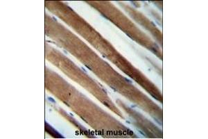 CCDC38 Antibody (Center) (ABIN654601 and ABIN2844300) immunohistochemistry analysis in formalin fixed and paraffin embedded human skeletal muscle followed by peroxidase conjugation of the secondary antibody and DAB staining.