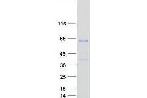 Validation with Western Blot