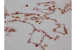 IHC image of ABIN7127313 diluted at 1:100 and staining in paraffin-embedded human lung tissue performed on a Leica BondTM system. (Recombinant ALOX5 anticorps)