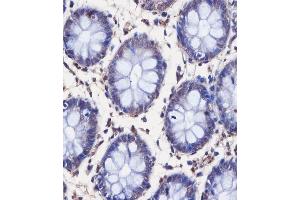 (ABIN6244013 and ABIN6578740) staining TAF4 in human colon tissue sections by Immunohistochemistry (IHC-P - paraformaldehyde-fixed, paraffin-embedded sections). (TAF4 anticorps  (AA 1021-1062))