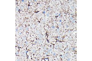 Immunohistochemistry of paraffin-embedded rat brain using GFAP Rabbit mAb (ABIN7267389) at dilution of 1:100 (40x lens).