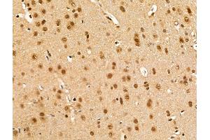 ABIN7094839 and ABIN7098890 at 1/100 staining Rat brain tissue by IHC-P. (IPO7 anticorps  (C-Term))