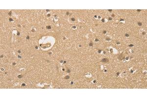 Immunohistochemistry of paraffin-embedded Human brain using ALDH8A1 Polyclonal Antibody at dilution of 1:30