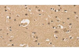 Immunohistochemistry of paraffin-embedded Human brain using ALDH8A1 Polyclonal Antibody at dilution of 1:30 (ALDH8A1 anticorps)