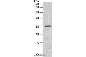 Western blot analysis of K562 cell, using PAX1 Polyclonal Antibody at dilution of 1:1200 (PAX1 anticorps)