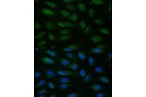 Immunofluorescence analysis of U-2 OS cells using HIBCH antibody (ABIN7265331) at dilution of 1:100.