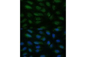 Immunofluorescence analysis of U-2 OS cells using HIBCH antibody (ABIN7265331) at dilution of 1:100. (HIBCH anticorps  (AA 33-330))