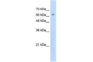 WB Suggested Anti-ZNF274 Antibody Titration: 2. (ZNF274 anticorps  (N-Term))