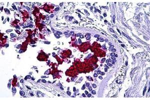Human Lung: Formalin-Fixed, Paraffin-Embedded (FFPE) (MUC5AC anticorps)