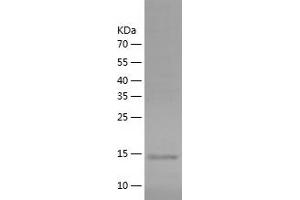 Platelet/endothelial Cell Adhesion Molecule (PECAM1) (AA 28-150) protein (His tag)