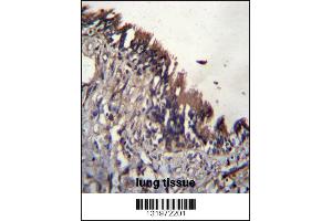 NUDT9 Antibody immunohistochemistry analysis in formalin fixed and paraffin embedded human lung tissue followed by peroxidase conjugation of the secondary antibody and DAB staining. (NUDT9 anticorps  (C-Term))