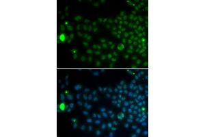 Immunofluorescence analysis of MCF7 cell using SPDYA antibody. (SPDYA anticorps  (AA 1-313))