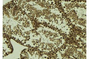 ABIN6273637 at 1/100 staining Mouse testis tissue by IHC-P. (HSPB9 anticorps  (C-Term))