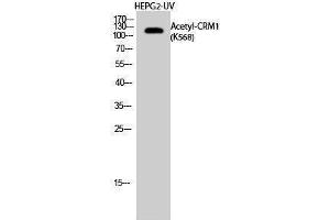 Western Blotting (WB) image for anti-Exportin 1 (XPO1) (acLys568) antibody (ABIN3188006) (XPO1 anticorps  (acLys568))