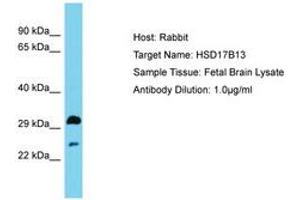 Image no. 1 for anti-Hydroxysteroid (17-Beta) Dehydrogenase 13 (HSD17B13) (AA 91-140) antibody (ABIN6750566) (HSD17B13 anticorps  (AA 91-140))