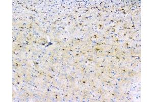 IHC analysis of LRTOMT using anti-LRTOMT antibody (ABIN7602986). (Leucine Rich Transmembrane and 0-Methyltransferase Domain Containing (LRTOMT) (Middle Region) anticorps)