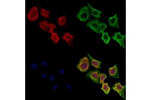 ABIN6264044 and ABIN6273287 staining Hela cells by IF/ICC. (Parvin, beta anticorps  (C-Term))