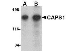 Western blot analysis of CAPS1 in rat brain tissue lysate with AP30179PU-N CAPS1 antibody at (A) 0.